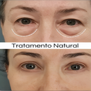 LumiEyes Collagen 3 em 1
