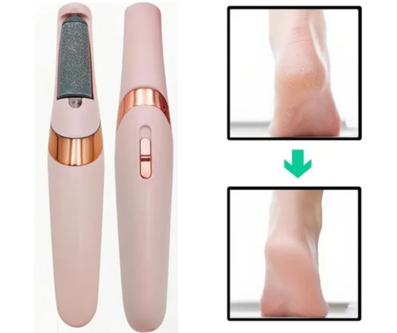 Removedor Elétrico de Calos e Pele Ressecada - Trezzi™